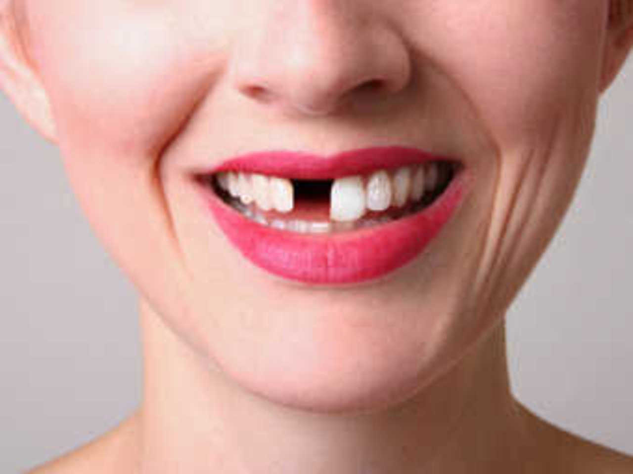 Фото с сайта leadingdentistry.com
