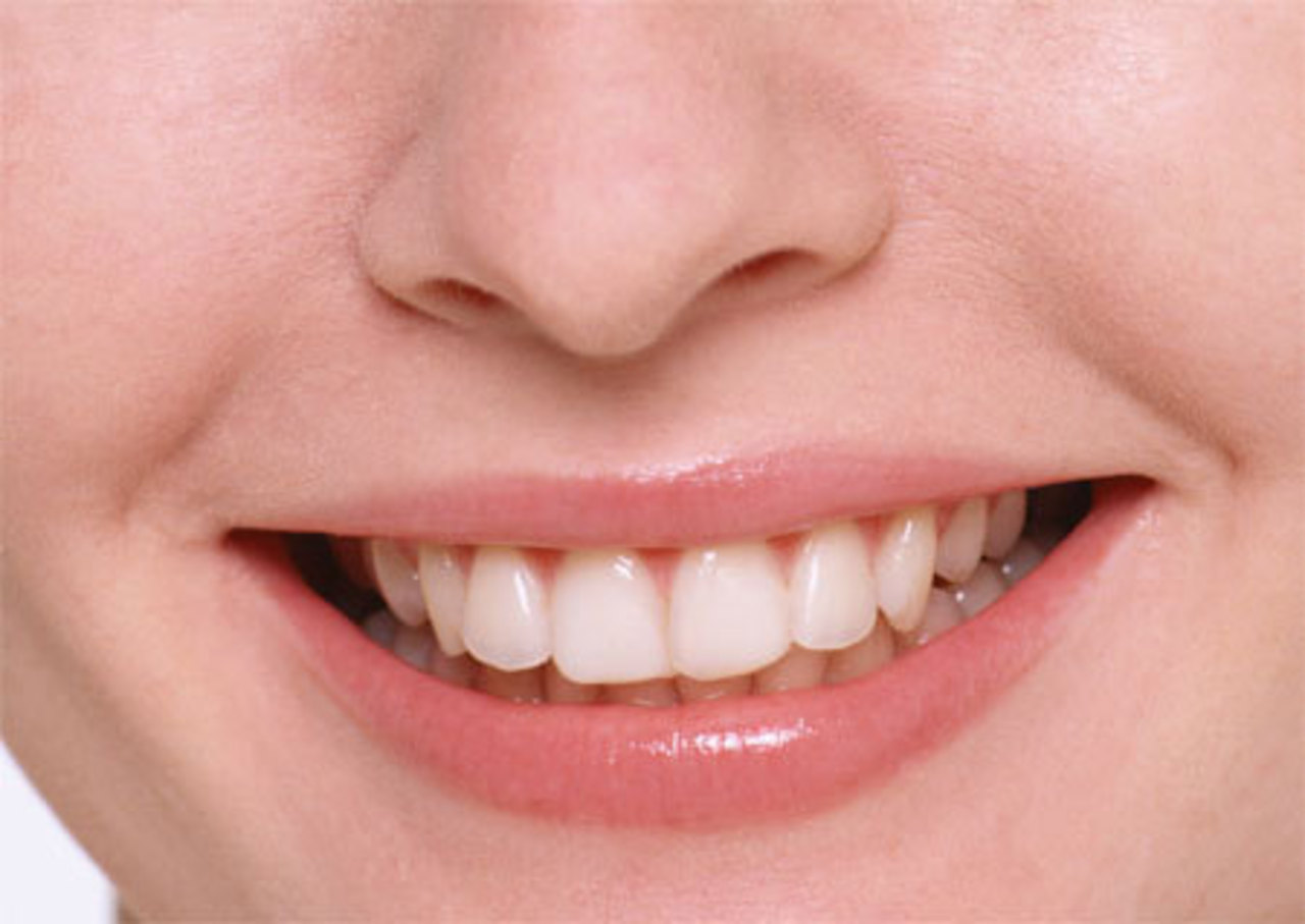 фото dental-parts.ru