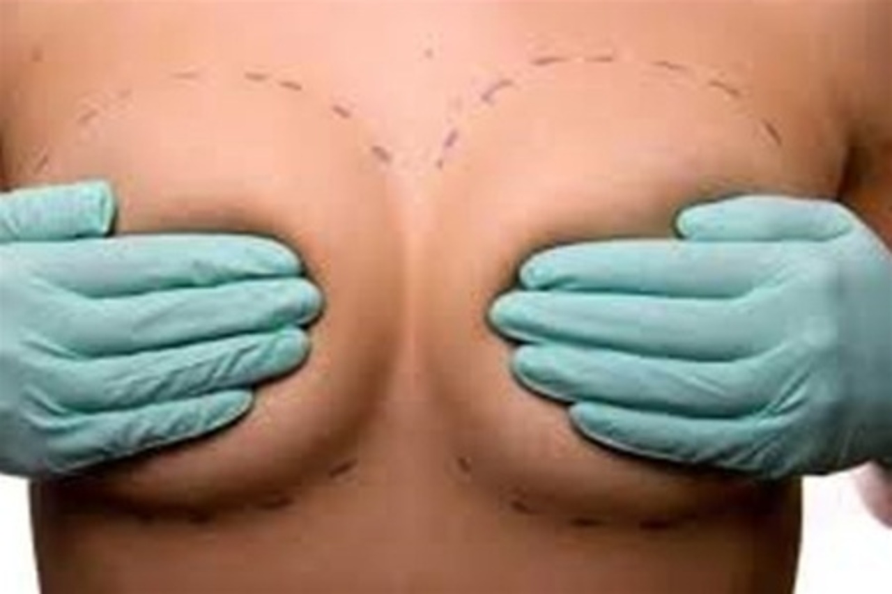 фото obozrevatel.com