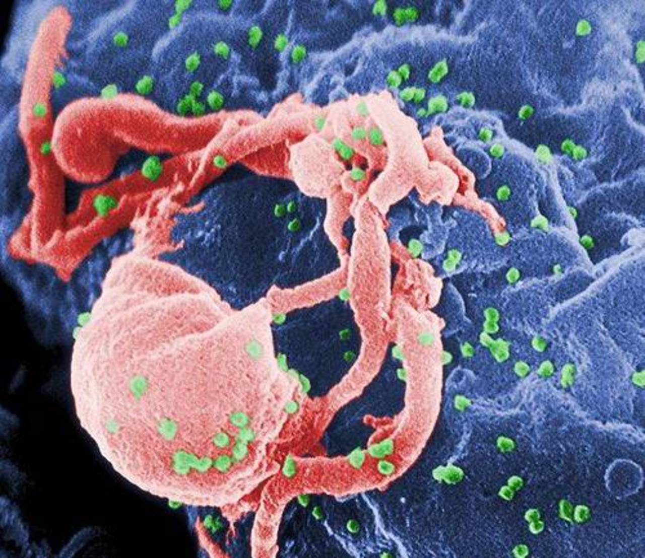 foto deadlymicrobes.com