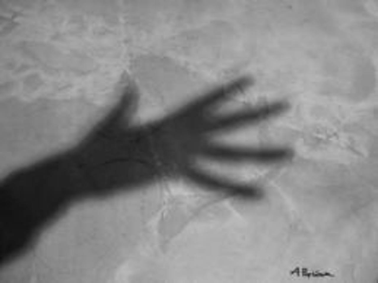 foto: renagne.com