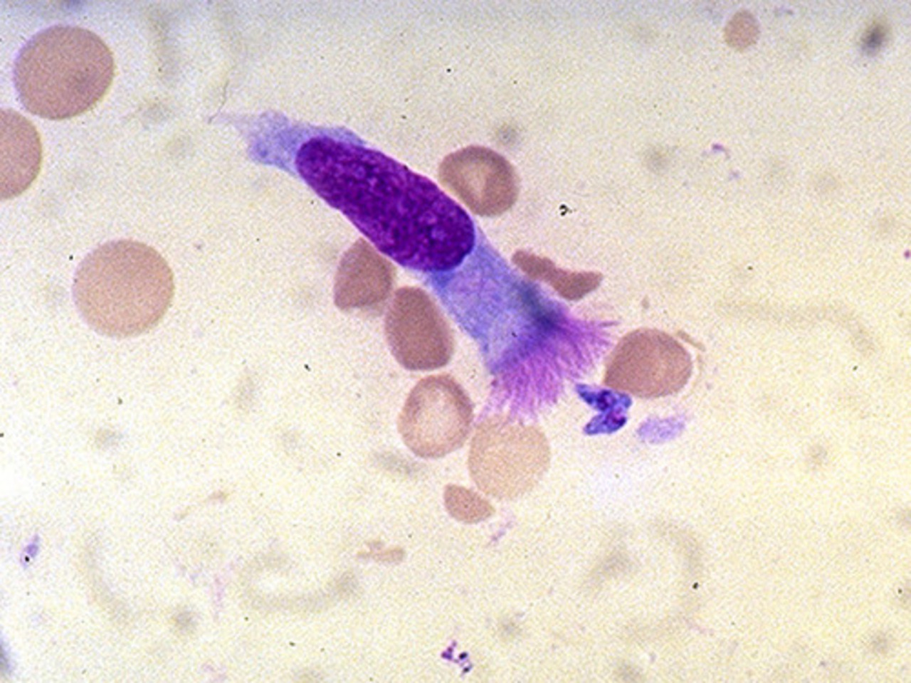 фото: pathology.washington.edu