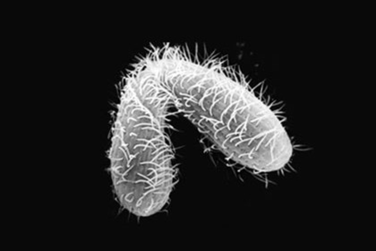 Спаривание двух инфузорий Tetrahymena thermophila. Фото: cornell.edu