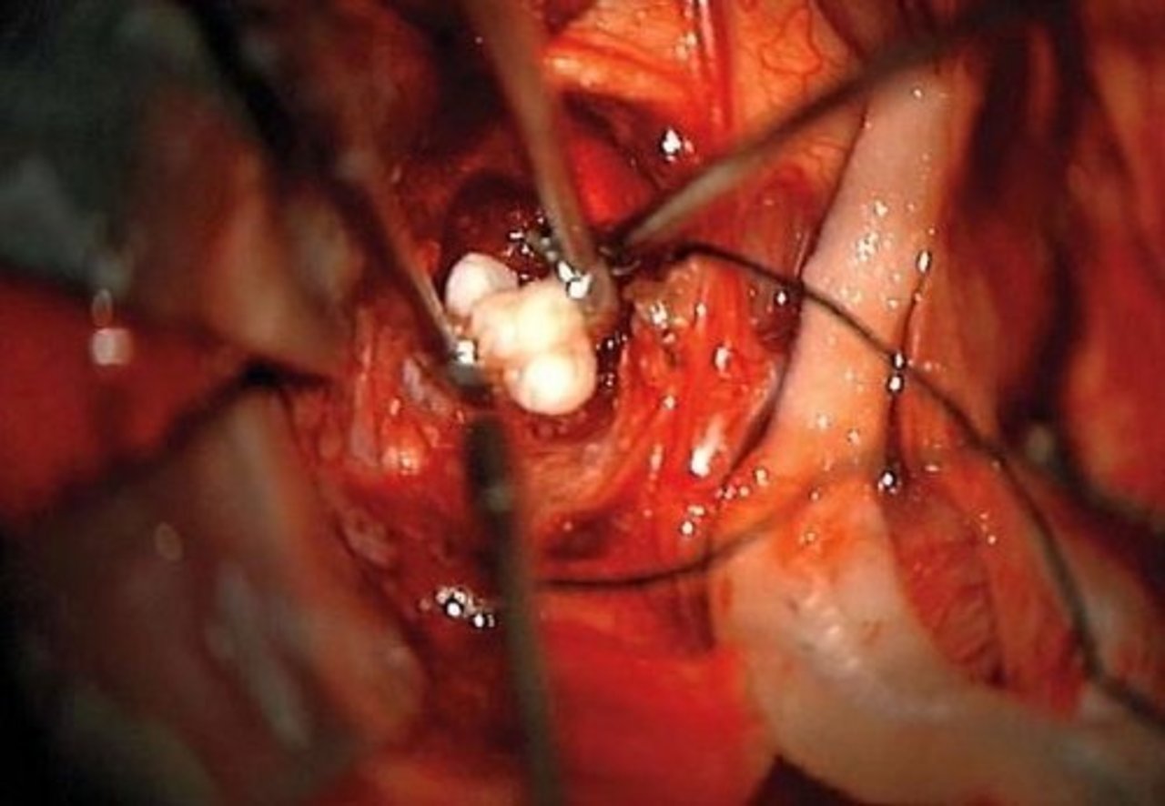 foto: The New England Journal of Medicine