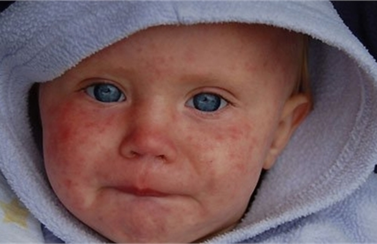 foto: epidemiolog.ru