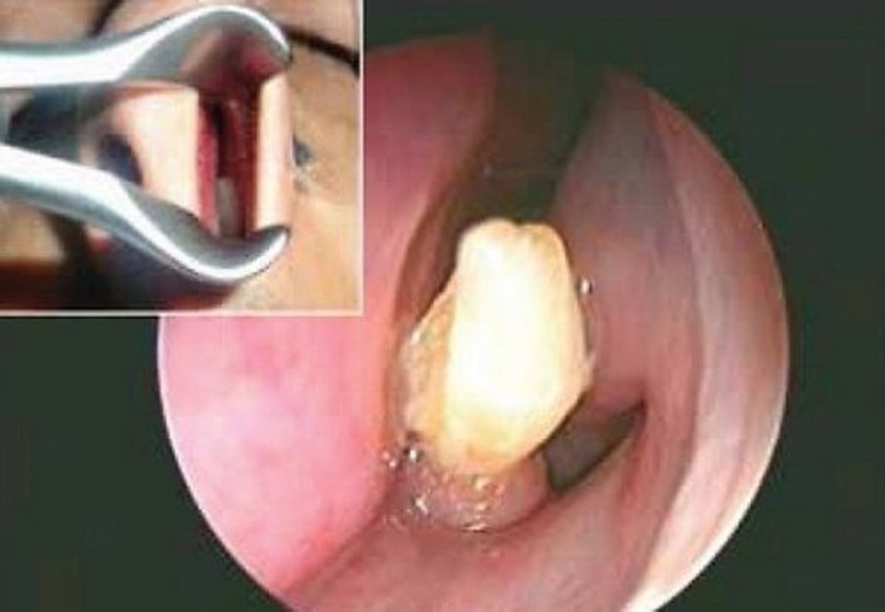 foto: The American Journal of Case Reports