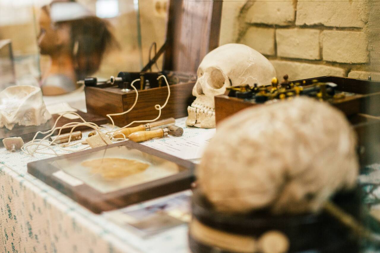 В зале истории медицины расположены экспонаты, связанные с лечением психических заболеваний, а также макеты мозга