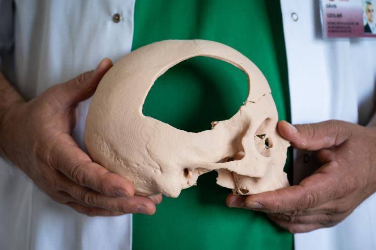 В Детской клинической больнице часть черепа заменили на 3D-печатную кость (фото)