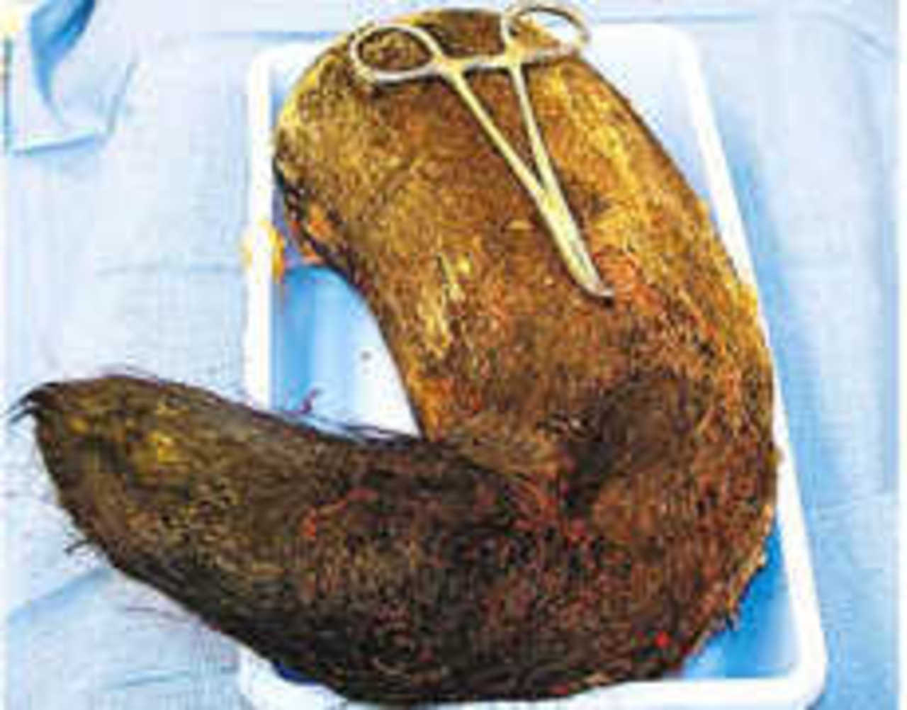 Фото New England Journal of Medicine.