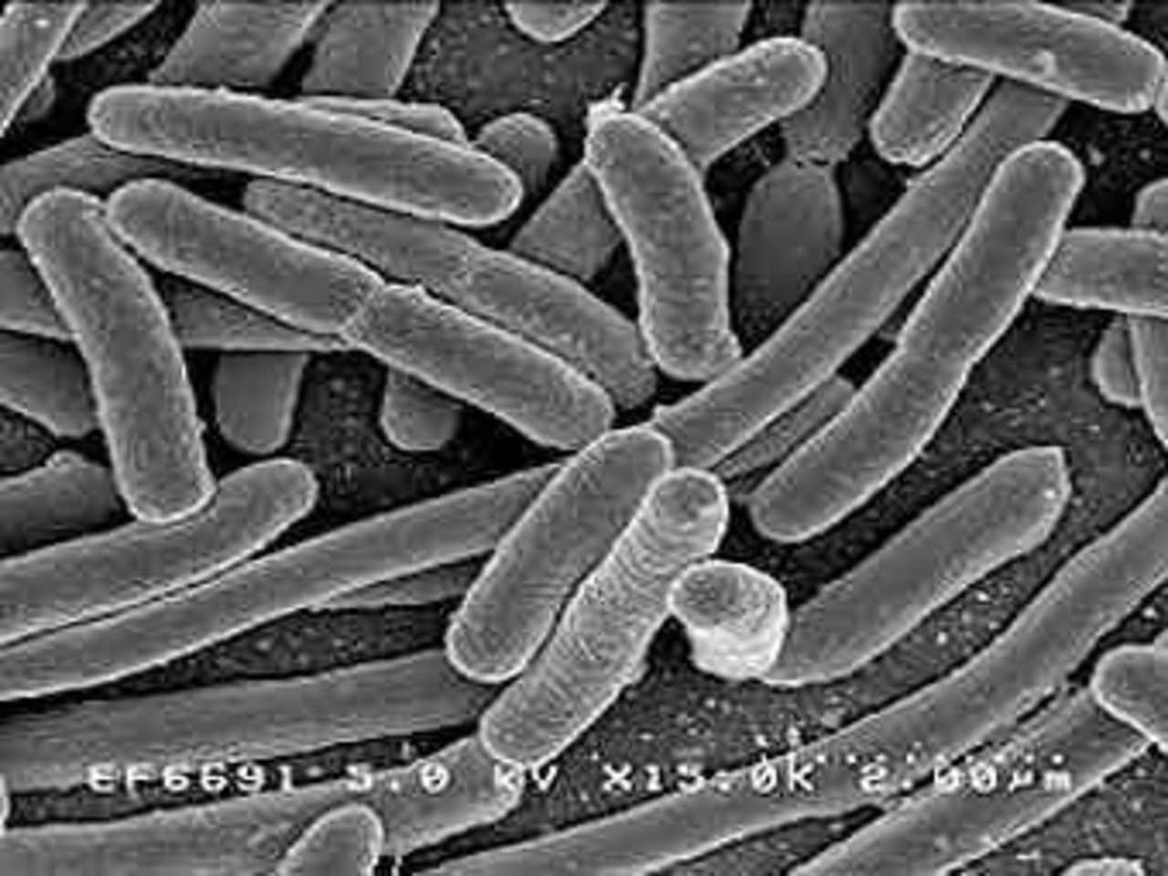 Кишечная палочка Escherichia coli. Фото Rocky Mountain Laboratories, NIAID, NIH
